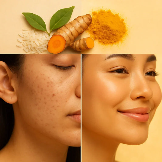 From Acne Scars to Glow: How Kojiecare Helps Heal and Renew Skin