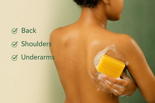 Kojic Acid Soap for Body Acne and Dark Marks: Back, Shoulders, Underarms & More