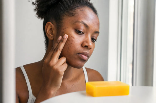 What Causes Uneven Skin Tone? Hidden Reasons You Didn't Know