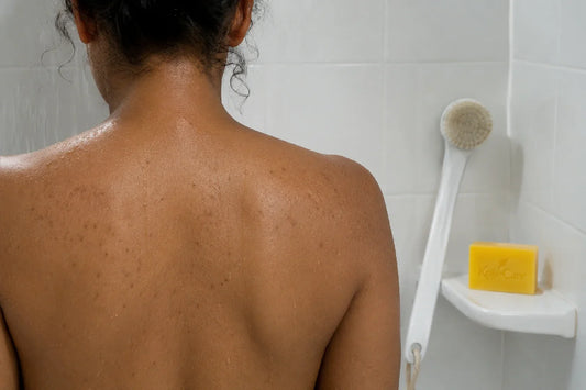 How to Fade Dark Spots on the Back and Chest — Causes, Coverage, and Body Routine