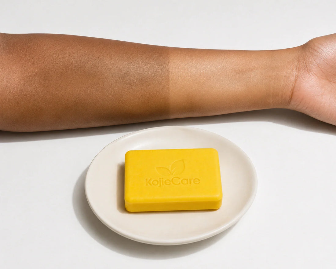 Is KojieCare Kojic Acid Soap Actually Worth It?