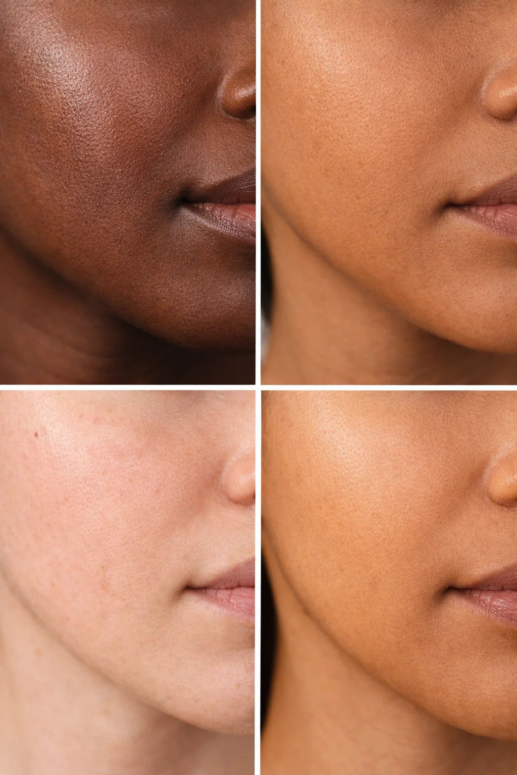 Which Skin Types Benefit Most from Kojic Acid Soap?