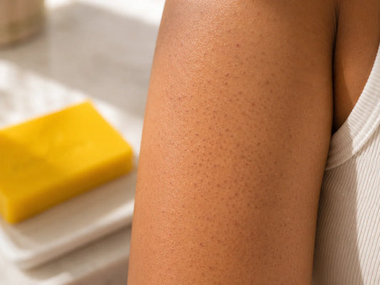 Kojic Acid Soap for Keratosis Pilaris-Related Darkening ("Strawberry Skin")