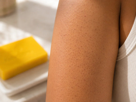 Kojic Acid Soap for Keratosis Pilaris-Related Darkening ("Strawberry Skin")