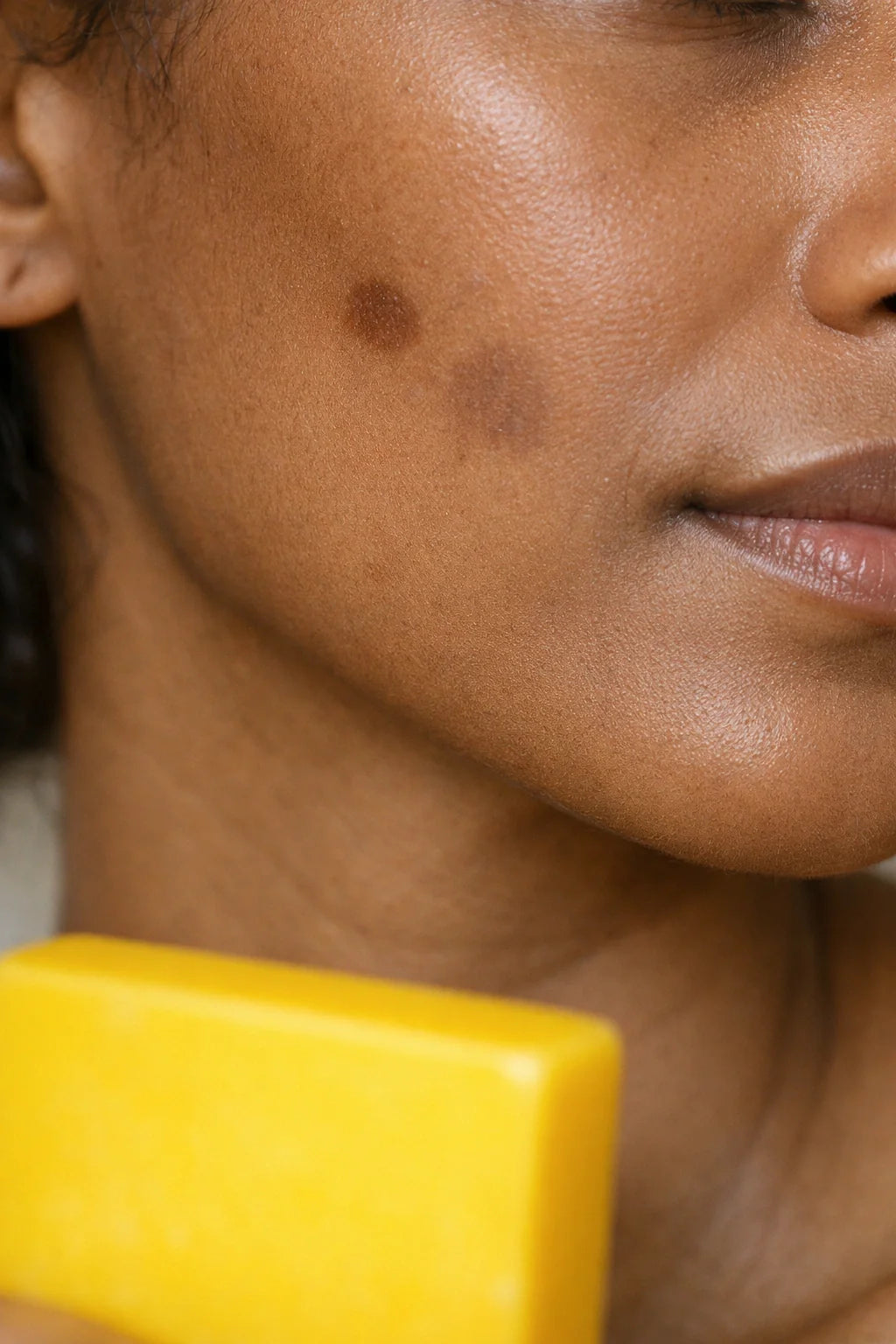 Why Some Dark Spots Fade Faster Than Others