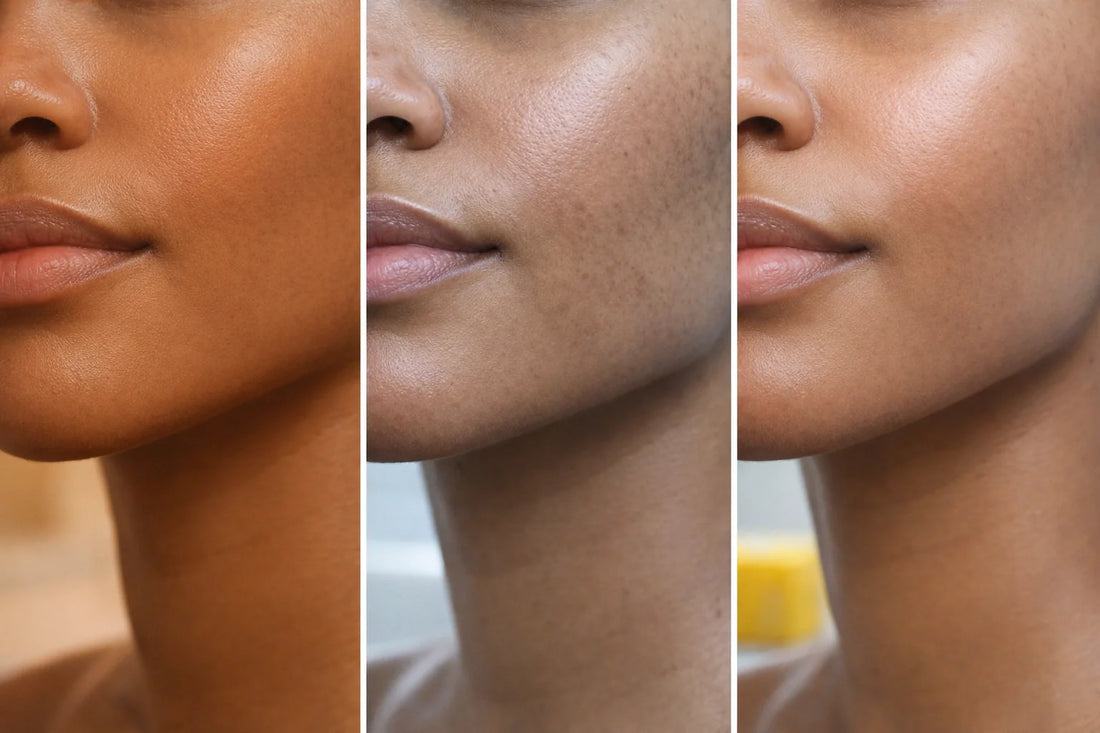 Why Your Skin Tone Looks Uneven in Different Lighting